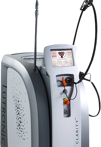 클라리티 레이저